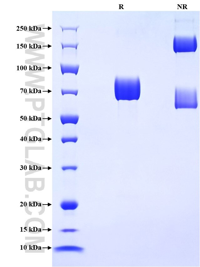 Purity of Recombinant Mouse CD147 was determined by SDS-PAGE. The protein was resolved in an SDS-PAGE in reducing (R) and non-reducing (NR) conditions and stained using Coomassie blue.