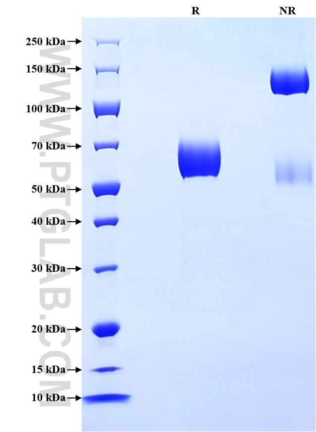 Purity of Recombinant Mouse IFN-gamma R1 was determined by SDS-PAGE. The protein was resolved in an SDS-PAGE in reducing (R) and non-reducing (NR) conditions and stained using Coomassie blue.