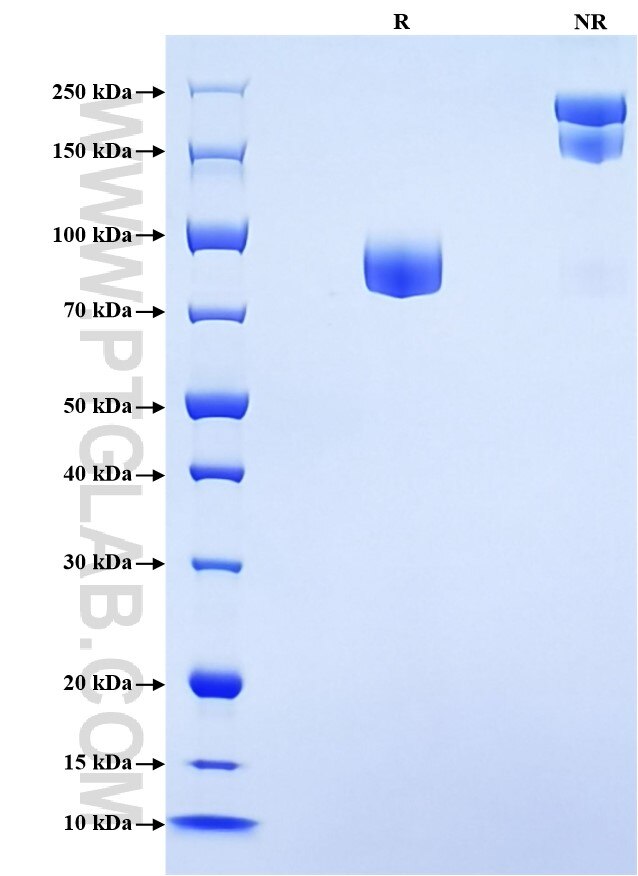 Purity of Recombinant Mouse CD98 was determined by SDS-PAGE. The protein was resolved in an SDS-PAGE in reducing (R) and non-reducing (NR) conditions and stained using Coomassie blue. Purity of Recombinant Mouse CD98 was determined by SDS-PAGE. The protein was resolved in an SDS-PAGE in reducing (R) and non-reducing (NR) conditions and stained using Coomassie blue.