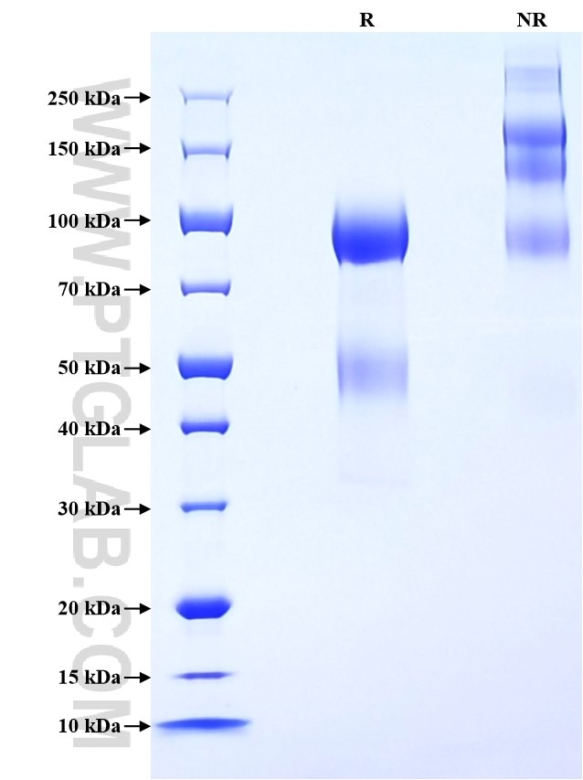 Purity of Recombinant Mouse MKI67 was determined by SDS-PAGE. The protein was resolved in an SDS-PAGE in reducing (R) and non-reducing (NR) conditions and stained using Coomassie blue.