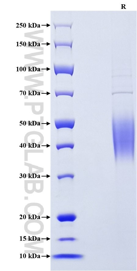 Purity of Recombinant Mouse 2B4 was determined by SDS-PAGE. The protein was resolved in an SDS-PAGE in reducing (R) conditions and stained using Coomassie blue. Purity of Recombinant Mouse 2B4 was determined by SDS-PAGE. The protein was resolved in an SDS-PAGE in reducing (R) conditions and stained using Coomassie blue.