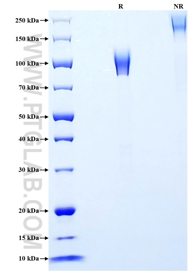 Purity of Recombinant Human CD30 was determined by SDS-PAGE. The protein was resolved in an SDS-PAGE in reducing (R) and non-reducing (NR) conditions and stained using Coomassie blue. Purity of Recombinant Human CD30 was determined by SDS-PAGE. The protein was resolved in an SDS-PAGE in reducing (R) and non-reducing (NR) conditions and stained using Coomassie blue.