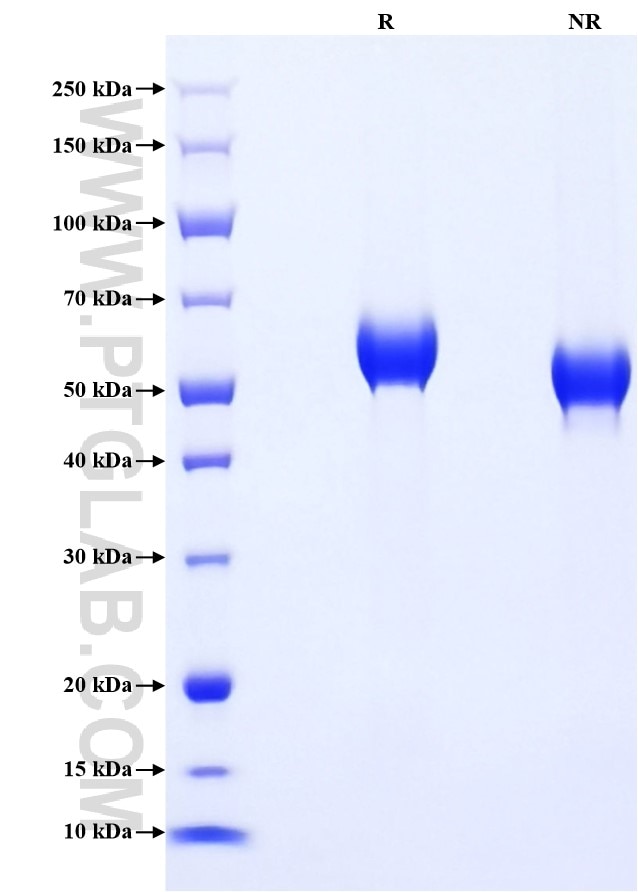 Purity of Recombinant Human ROR1 was determined by SDS-PAGE. The protein was resolved in an SDS-PAGE in reducing (R) and non-reducing (NR) conditions and stained using Coomassie blue. Purity of Recombinant Human ROR1 was determined by SDS-PAGE. The protein was resolved in an SDS-PAGE in reducing (R) and non-reducing (NR) conditions and stained using Coomassie blue.