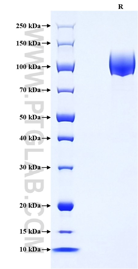 Purity of Recombinant Mouse PDGF R alpha was determined by SDS-PAGE. The protein was resolved in an SDS-PAGE in reducing (R) condition and stained using Coomassie blue. Purity of Recombinant Mouse PDGF R alpha was determined by SDS-PAGE. The protein was resolved in an SDS-PAGE in reducing (R) condition and stained using Coomassie blue.