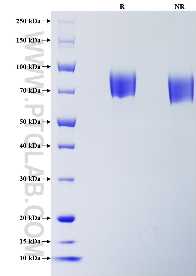 Purity of Recombinant Mouse PDGF R alpha was determined by SDS-PAGE. The protein was resolved in an SDS-PAGE in reducing (R) and non-reducing (NR) conditions and stained using Coomassie blue.