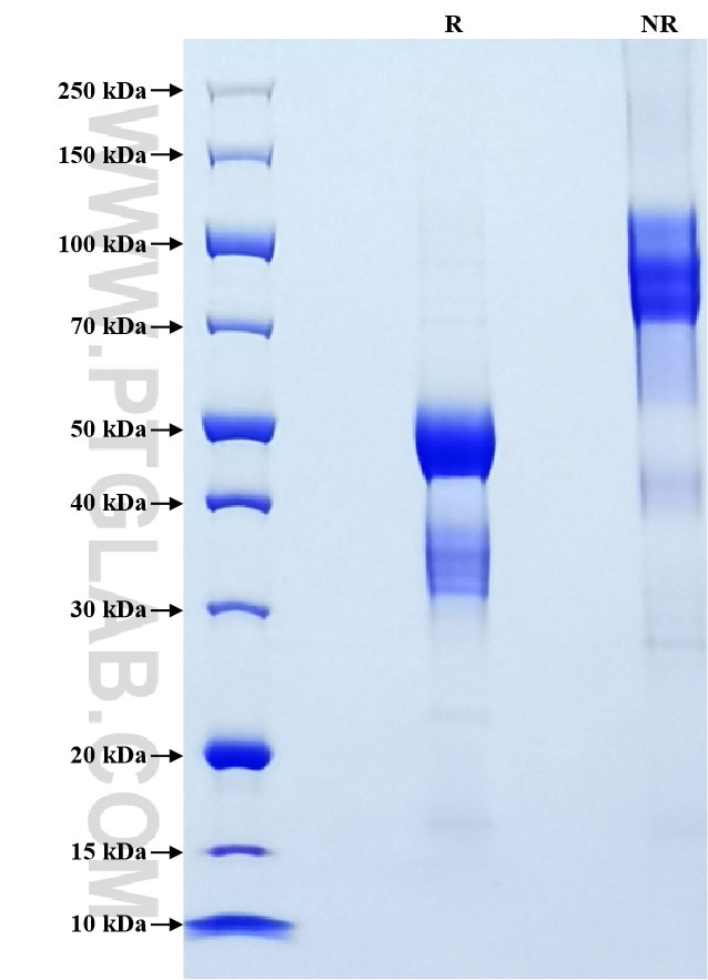 Purity of Recombinant Human TNFRSF13B was determined by SDS-PAGE. The protein was resolved in an SDS-PAGE in reducing (R) and non-reducing (NR) conditions and stained using Coomassie blue. Purity of Recombinant Human TNFRSF13B was determined by SDS-PAGE. The protein was resolved in an SDS-PAGE in reducing (R) and non-reducing (NR) conditions and stained using Coomassie blue.