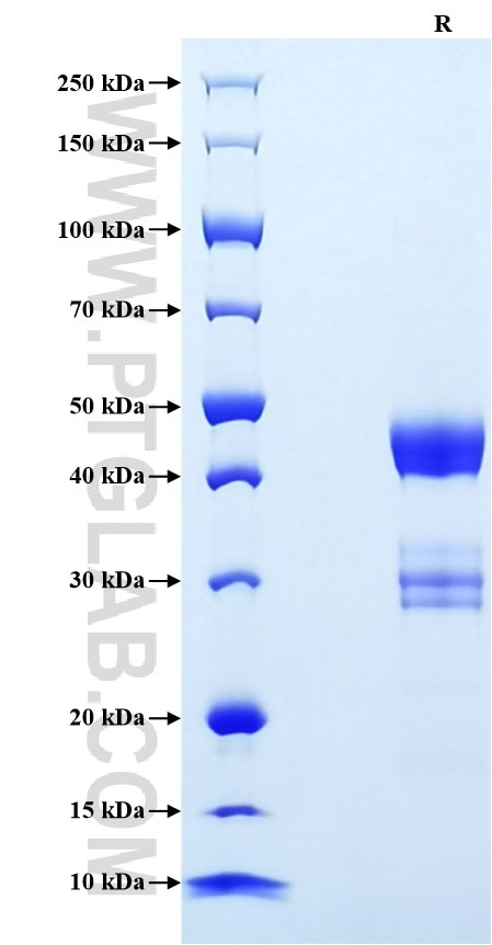 Purity of Recombinant Mouse VEGF-C was determined by SDS-PAGE. The protein was resolved in an SDS-PAGE in reducing (R) conditions and stained using Coomassie blue.