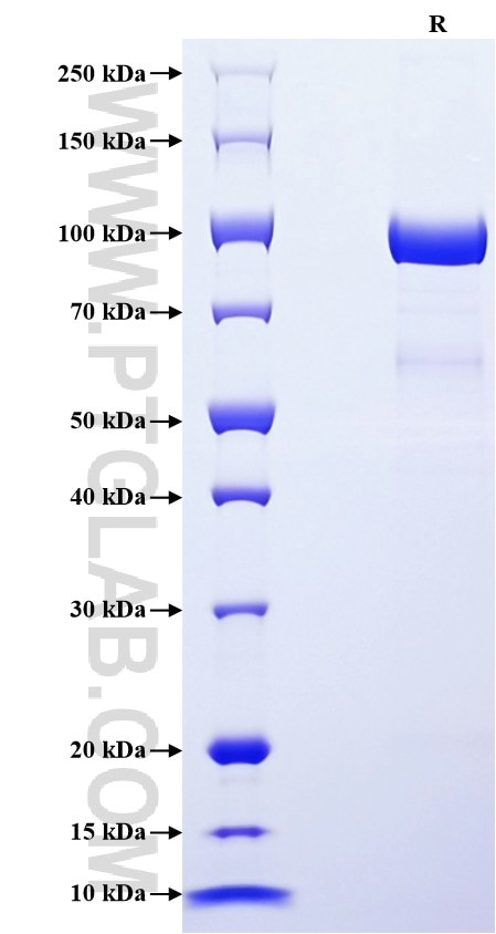Purity of Recombinant Human MMP-2 was determined by SDS-PAGE. The protein was resolved in an SDS-PAGE in reducing (R) conditions and stained using Coomassie blue. Purity of Recombinant Human MMP-2 was determined by SDS-PAGE. The protein was resolved in an SDS-PAGE in reducing (R) conditions and stained using Coomassie blue.