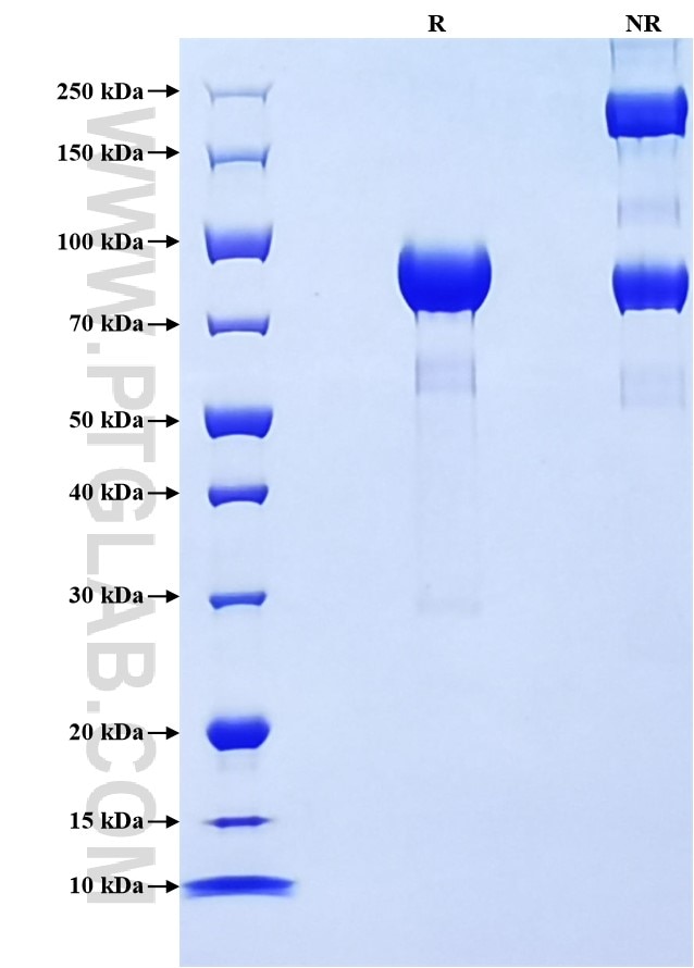 Purity of Recombinant Human IL-3RB was determined by SDS-PAGE. The protein was resolved in an SDS-PAGE in reducing (R) and non-reducing (NR) conditions and stained using Coomassie blue.