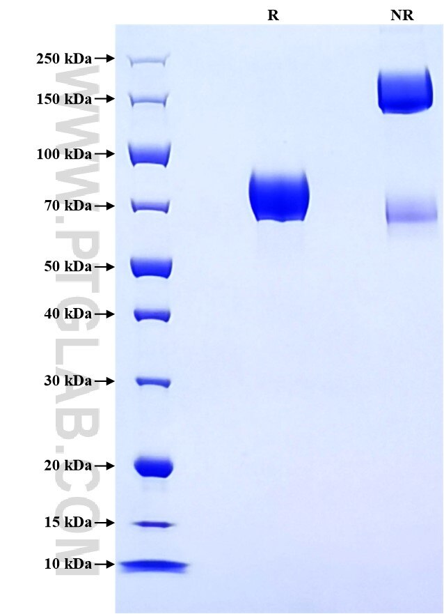Purity of Recombinant Human SIRP beta 1 was determined by SDS-PAGE. The protein was resolved in an SDS-PAGE in reducing (R) and non-reducing (NR) conditions and stained using Coomassie blue.