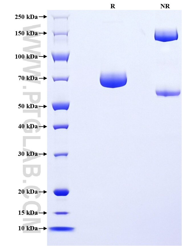 Purity of Recombinant Human Nectin-2 was determined by SDS-PAGE. The protein was resolved in an SDS-PAGE in reducing (R) and non-reducing (NR) conditions and stained using Coomassie blue. Purity of Recombinant Human Nectin-2 was determined by SDS-PAGE. The protein was resolved in an SDS-PAGE in reducing (R) and non-reducing (NR) conditions and stained using Coomassie blue.