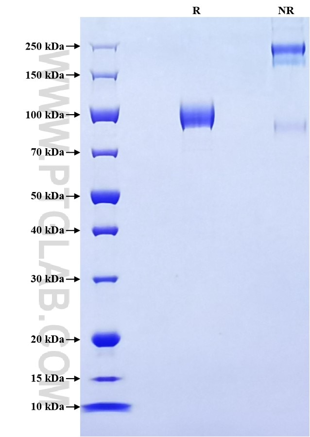 Purity of Recombinant Human Siglec-5 was determined by SDS-PAGE. The protein was resolved in an SDS-PAGE in reducing (R) and non-reducing (NR) conditions and stained using Coomassie blue.