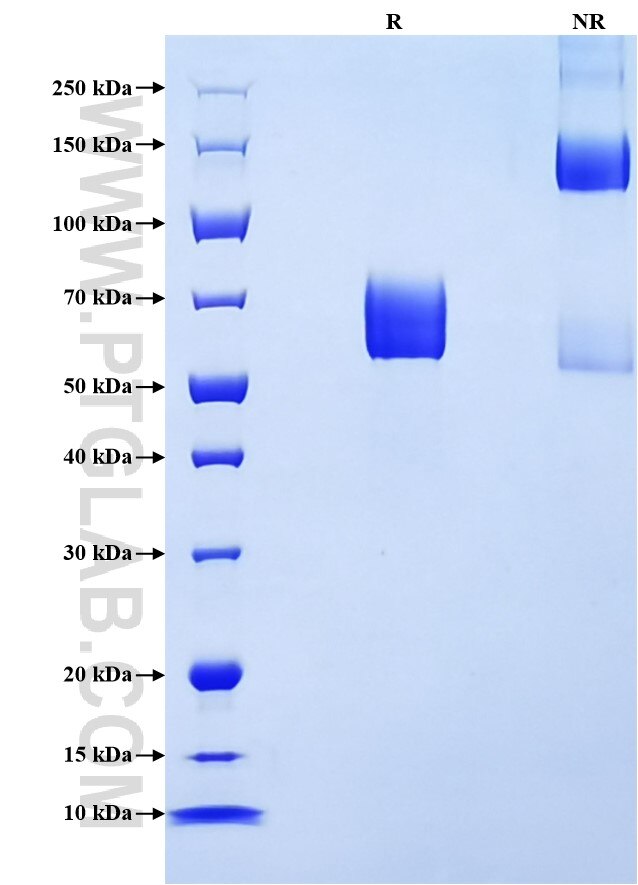 Purity of Recombinant Human IL-4RA was determined by SDS-PAGE. The protein was resolved in an SDS-PAGE in reducing (R) conditions and non-reducing (NR) conditions and stained using Coomassie blue.