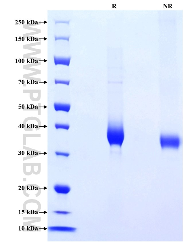 Purity of Recombinant Human CD122 was determined by SDS-PAGE. The protein was resolved in an SDS-PAGE in reducing (R) and non-reducing (NR) conditions and stained using Coomassie blue.