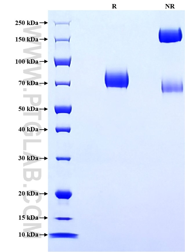 Purity of Recombinant Human Nectin-1 was determined by SDS-PAGE. The protein was resolved in an SDS-PAGE in reducing (R) and non-reducing (NR) conditions and stained using Coomassie blue. Purity of Recombinant Human Nectin-1 was determined by SDS-PAGE. The protein was resolved in an SDS-PAGE in reducing (R) and non-reducing (NR) conditions and stained using Coomassie blue.