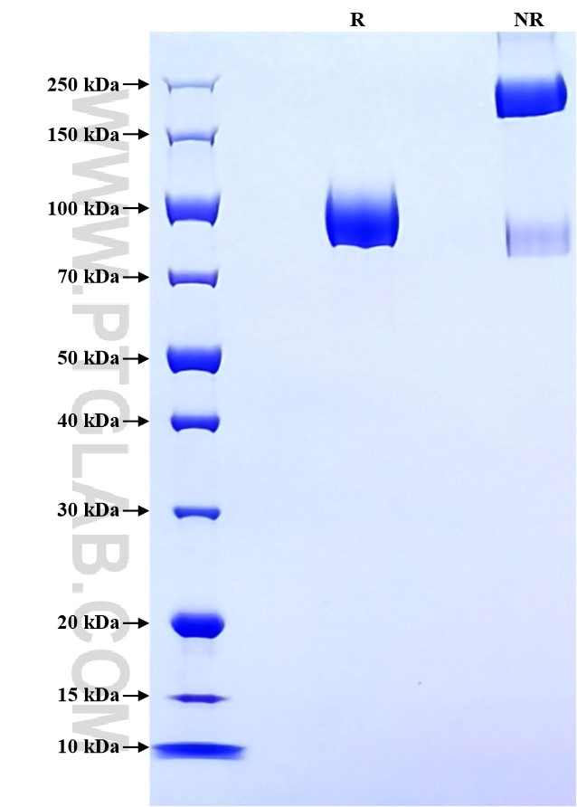 Purity of Recombinant Human LILRA2 was determined by SDS-PAGE. The protein was resolved in an SDS-PAGE in reducing (R) and non-reducing (NR) conditions and stained using Coomassie blue. Purity of Recombinant Human LILRA2 was determined by SDS-PAGE. The protein was resolved in an SDS-PAGE in reducing (R) and non-reducing (NR) conditions and stained using Coomassie blue.