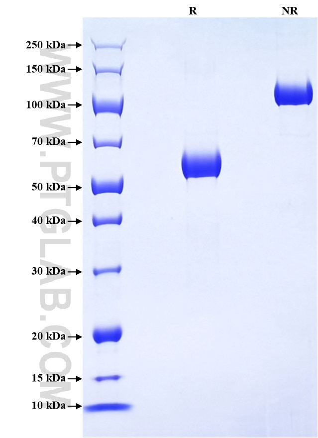 Purity of Recombinant Human CD72 was determined by SDS-PAGE. The protein was resolved in an SDS-PAGE in reducing (R) and non-reducing (NR) conditions and stained using Coomassie blue. Purity of Recombinant Human CD72 was determined by SDS-PAGE. The protein was resolved in an SDS-PAGE in reducing (R) and non-reducing (NR) conditions and stained using Coomassie blue.