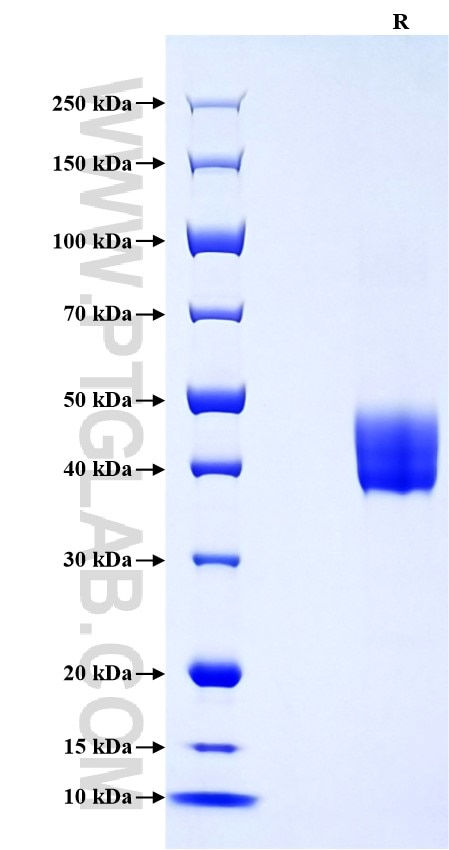 Purity of Recombinant Human CD59 was determined by SDS-PAGE. The protein was resolved in an SDS-PAGE in reducing (R) conditions and stained using Coomassie blue.
