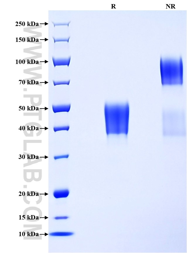 Purity of Recombinant Human CD24 was determined by SDS-PAGE. The protein was resolved in an SDS-PAGE in reducing (R) and non-reducing (NR) conditions and stained using Coomassie blue.