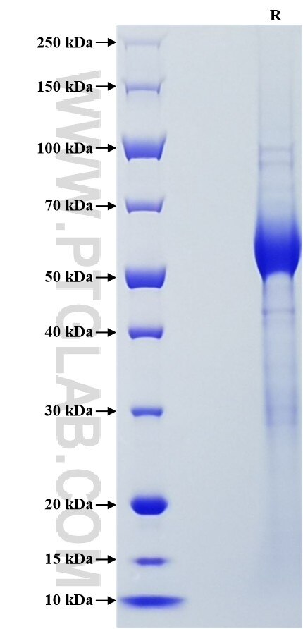 Purity of Recombinant Human CD161 was determined by SDS-PAGE. The protein was resolved in an SDS-PAGE in reducing (R) conditions and stained using Coomassie blue.