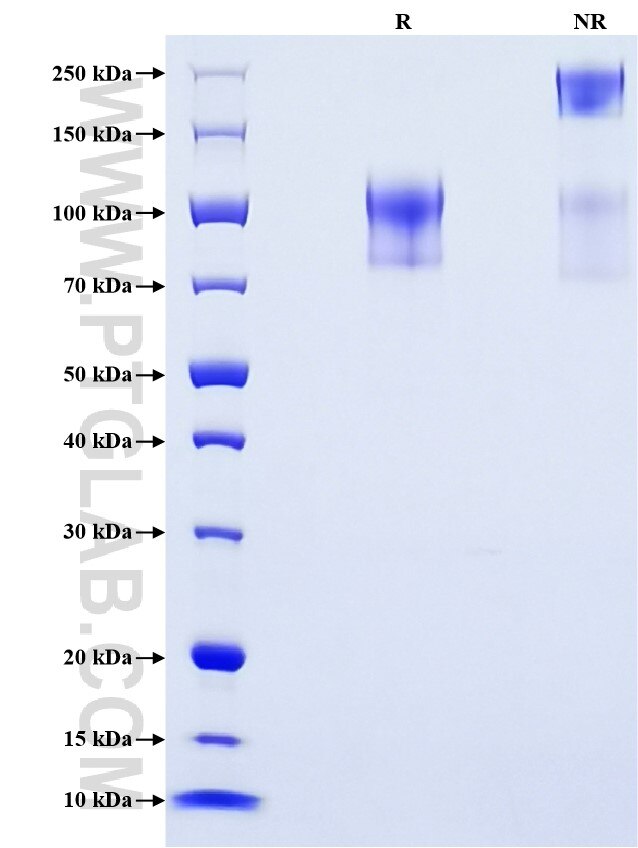 Purity of Recombinant Human CD34 was determined by SDS-PAGE. The protein was resolved in an SDS-PAGE in reducing (R) and non-reducing (NR) conditions and stained using Coomassie blue.