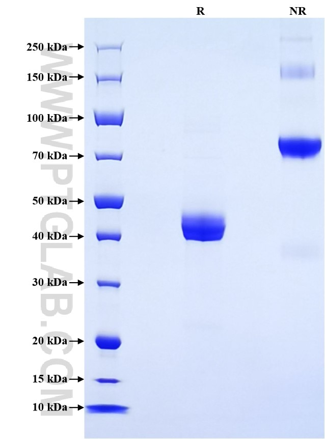 Purity of Recombinant Mouse TNFRSF13B was determined by SDS-PAGE. The protein was resolved in an SDS-PAGE in reducing (R) and non-reducing (NR) conditions and stained using Coomassie blue.