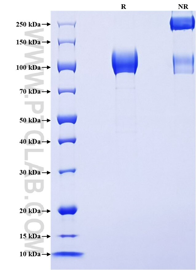 Purity of Recombinant Mouse CSF1R was determined by SDS-PAGE. The protein was resolved in an SDS-PAGE in reducing (R) and non-reducing (NR) conditions and stained using Coomassie blue.