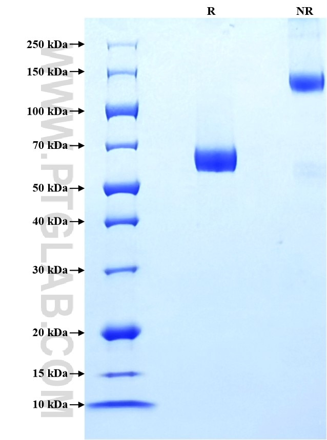 Purity of Recombinant Mouse IL-7Ra was determined by SDS-PAGE. The protein was resolved in an SDS-PAGE in reducing (R) and non-reducing (NR) conditions and stained using Coomassie blue.