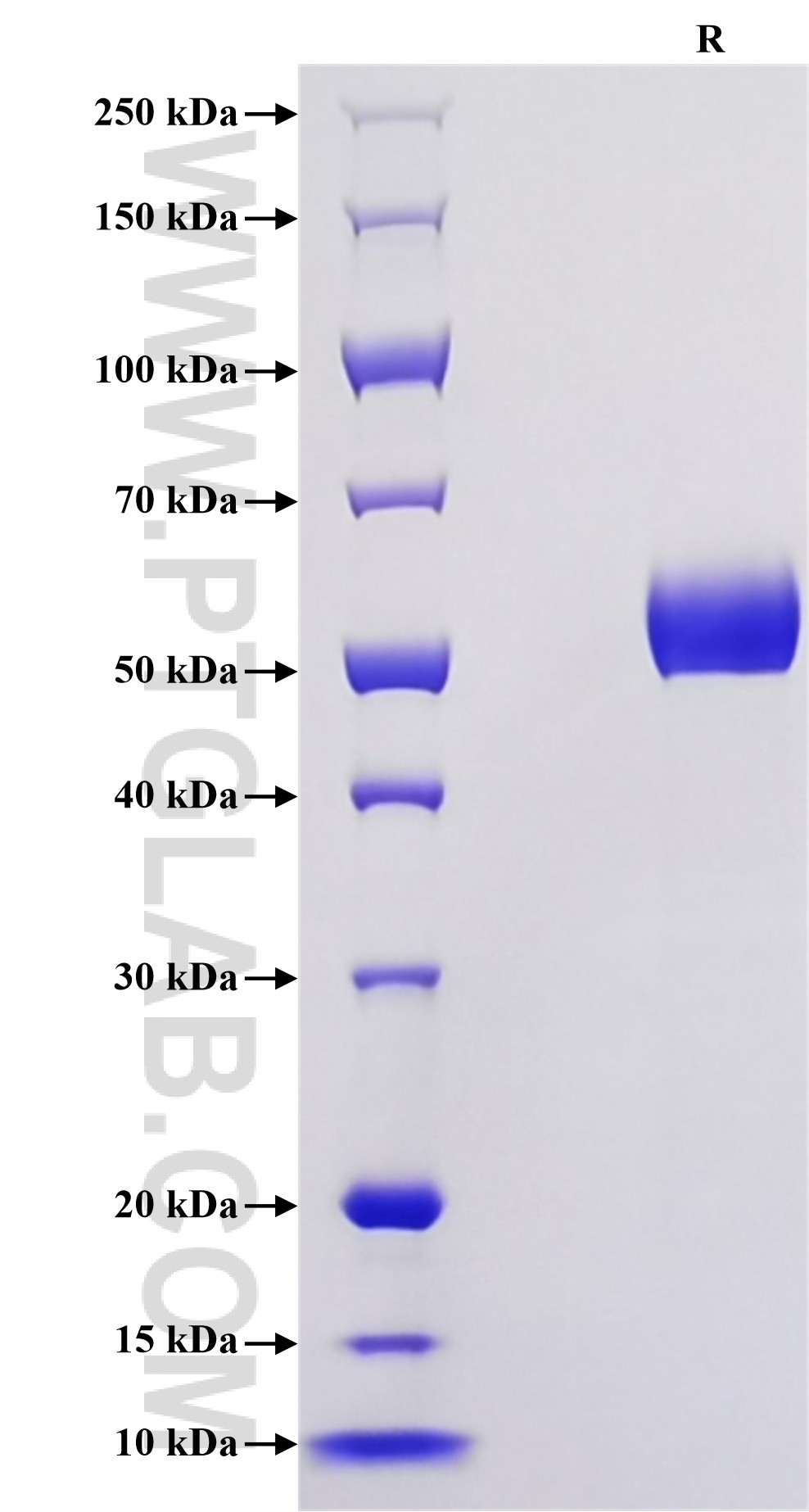 Purity of Recombinant Mouse RANK was determined by SDS-PAGE. The protein was resolved in an SDS-PAGE in reducing (R) conditions and stained using Coomassie blue.