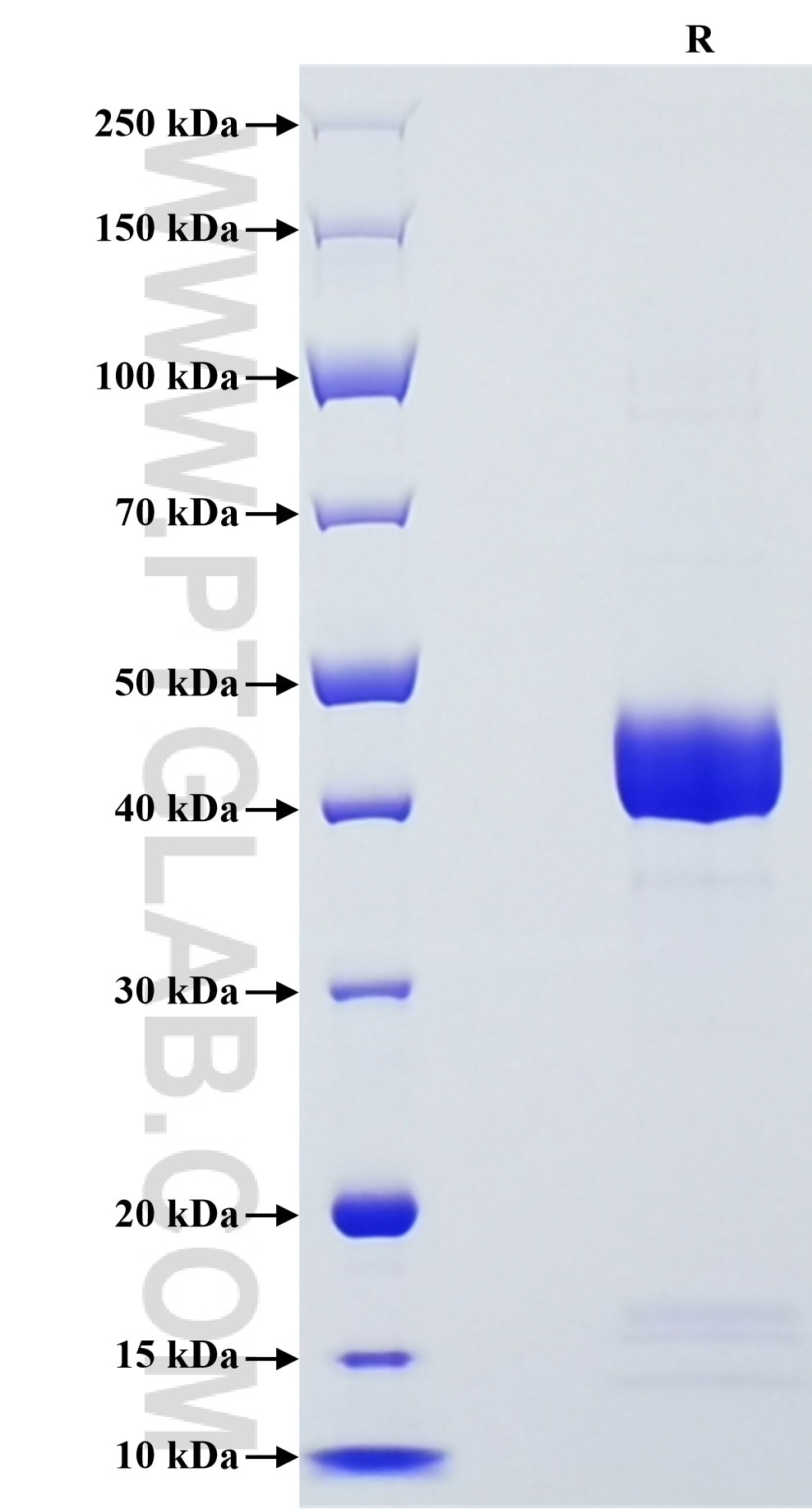 Purity of Recombinant Human Angiogenin was determined by SDS-PAGE. The protein was resolved in an SDS-PAGE in reducing (R) conditions and stained using Coomassie blue.