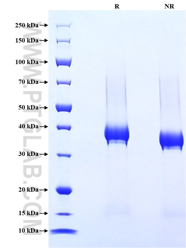 Purity of Recombinant Human CD23 was determined by SDS-PAGE. The protein was resolved in an SDS-PAGE in reducing (R) and non-reducing (NR) conditions and stained using Coomassie blue. Purity of Recombinant Human CD23 was determined by SDS-PAGE. The protein was resolved in an SDS-PAGE in reducing (R) and non-reducing (NR) conditions and stained using Coomassie blue.