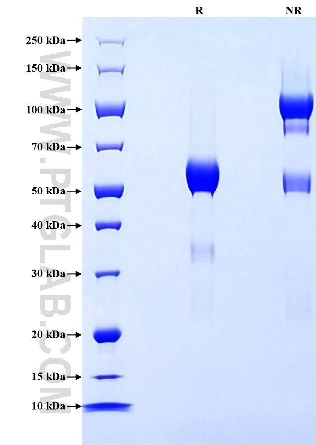 Purity of Recombinant Human CD74 was determined by SDS-PAGE. The protein was resolved in an SDS-PAGE in reducing (R) and non-reducing (NR) conditions and stained using Coomassie blue.