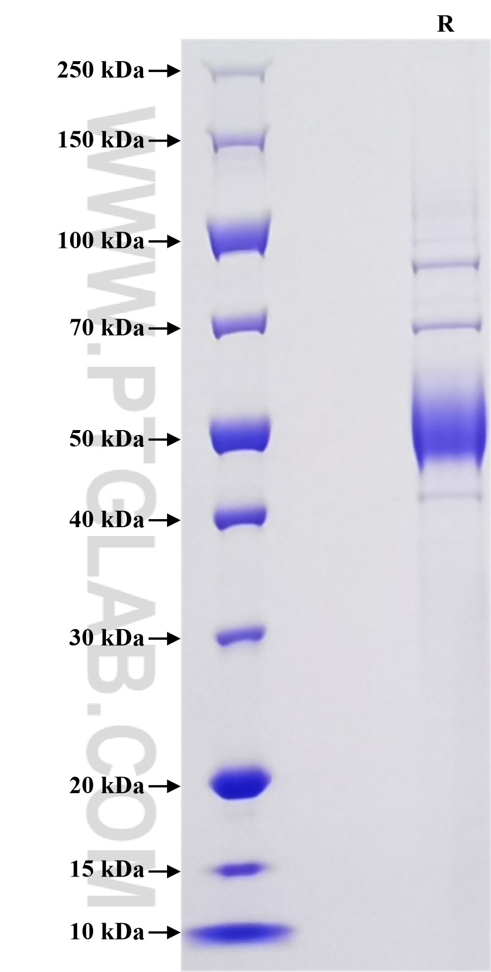 Purity of Recombinant Human NKG2C was determined by SDS-PAGE. The protein was resolved in an SDS-PAGE in reducing (R) conditions and stained using Coomassie blue.
