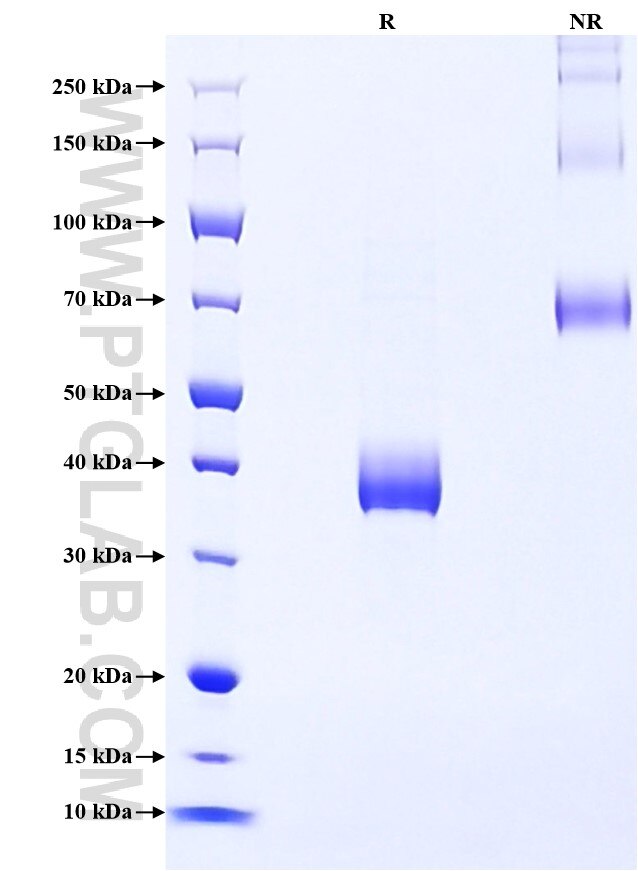 Purity of Recombinant Rat IGF-1 was determined by SDS-PAGE. The protein was resolved in an SDS-PAGE in reducing (R) and non-reducing (NR) conditions and stained using Coomassie blue.
