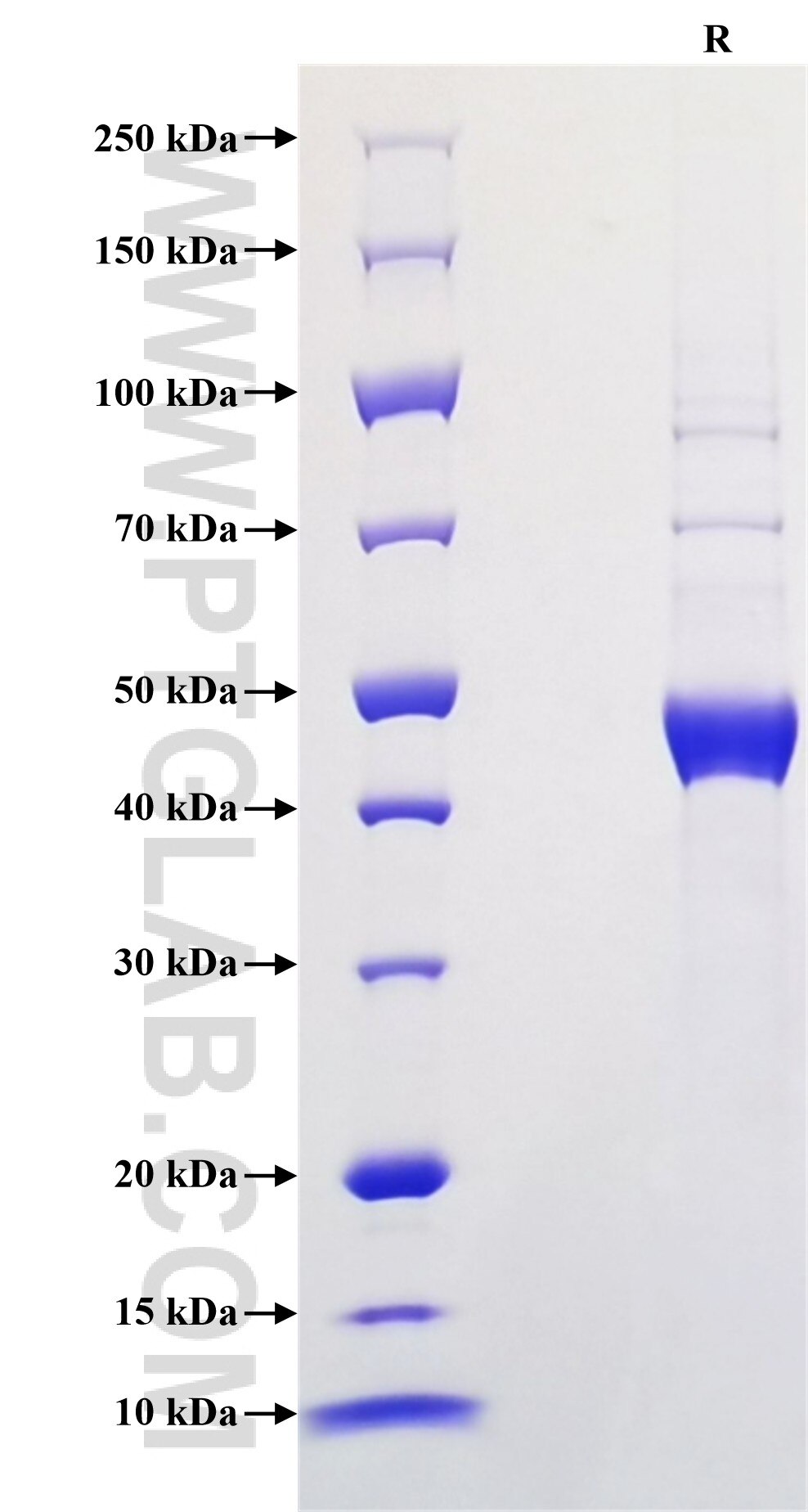 Purity of Recombinant Human IL-15 was determined by SDS-PAGE. The protein was resolved in an SDS-PAGE in reducing (R) conditions and stained using Coomassie blue. Purity of Recombinant Human IL-15 was determined by SDS-PAGE. The protein was resolved in an SDS-PAGE in reducing (R) conditions and stained using Coomassie blue.