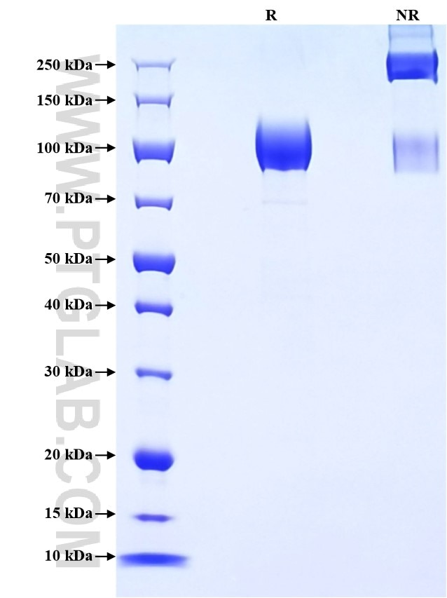 Purity of Recombinant Human CD117 was determined by SDS-PAGE. The protein was resolved in an SDS-PAGE in reducing (R) and non-reducing (NR) conditions and stained using Coomassie blue. Purity of Recombinant Human CD117 was determined by SDS-PAGE. The protein was resolved in an SDS-PAGE in reducing (R) and non-reducing (NR) conditions and stained using Coomassie blue.