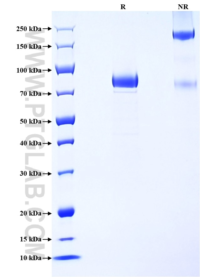 Purity of Recombinant Human CSF2RA was determined by SDS-PAGE. The protein was resolved in an SDS-PAGE in reducing (R) and non-reducing (NR) conditions and stained using Coomassie blue. Purity of Recombinant Human CSF2RA was determined by SDS-PAGE. The protein was resolved in an SDS-PAGE in reducing (R) and non-reducing (NR) conditions and stained using Coomassie blue.