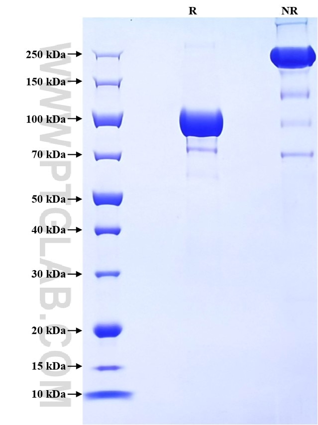 Purity of Recombinant Human SEMA7A was determined by SDS-PAGE. The protein was resolved in an SDS-PAGE in reducing (R) and non-reducing (NR) conditions and stained using Coomassie blue.