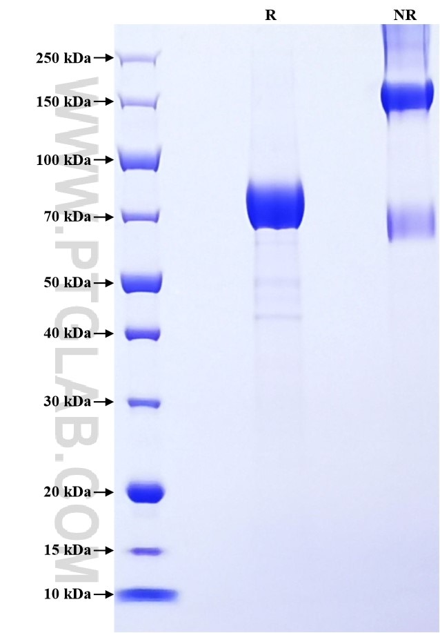 Purity of Recombinant Human IL-3RA was determined by SDS-PAGE. The protein was resolved in an SDS-PAGE in reducing (R) and non-reducing (NR) conditions and stained using Coomassie blue.