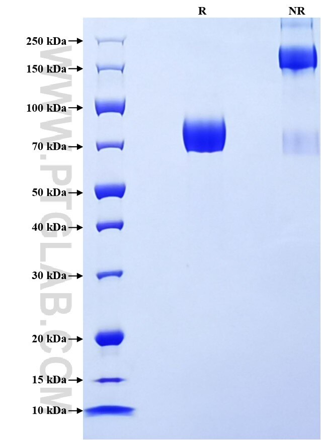 Purity of Recombinant Mouse CSF2RA was determined by SDS-PAGE. The protein was resolved in an SDS-PAGE in reducing (R) and non-reducing (NR) conditions and stained using Coomassie blue.