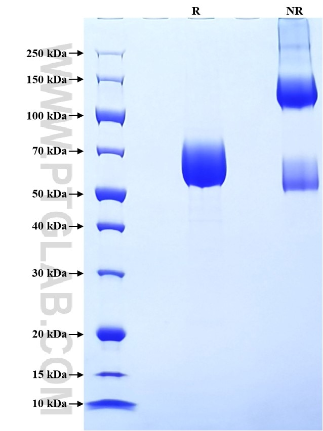 Purity of Recombinant Human Fc Epsilon RI Alpha was determined by SDS-PAGE. The protein was resolved in an SDS-PAGE in reducing (R) and non-reducing (NR) conditions and stained using Coomassie blue.