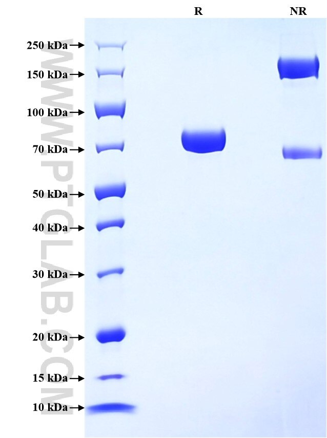 Purity of Recombinant Rat CD4 was determined by SDS-PAGE. The protein was resolved in an SDS-PAGE in reducing (R) and non-reducing (NR) conditions and stained using Coomassie blue.