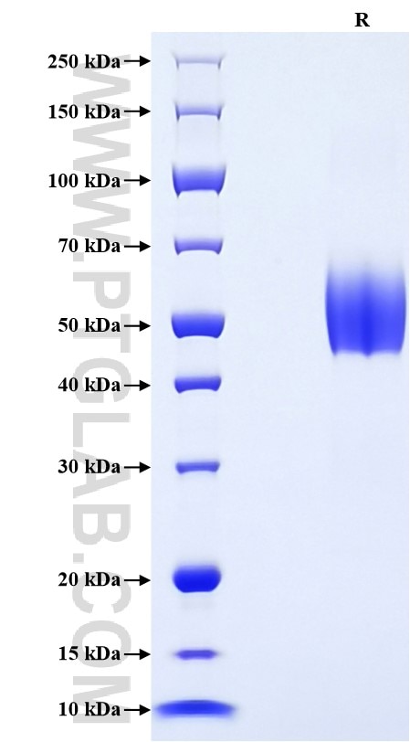 Purity of Recombinant Human CD79A was determined by SDS-PAGE. The protein was resolved in an SDS-PAGE in reducing (R) conditions and stained using Coomassie blue.