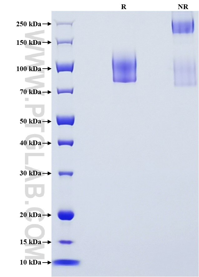 Purity of Recombinant Human CD68 was determined by SDS-PAGE. The protein was resolved in an SDS-PAGE in reducing (R) and non-reducing (NR) conditions and stained using Coomassie blue.