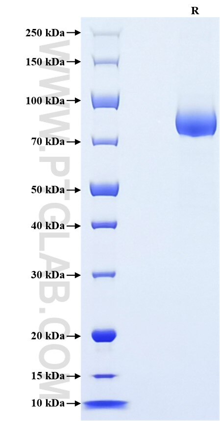 Purity of Recombinant Human Siglec-6 was determined by SDS-PAGE. The protein was resolved in an SDS-PAGE in reducing (R) conditions and stained using Coomassie blue.