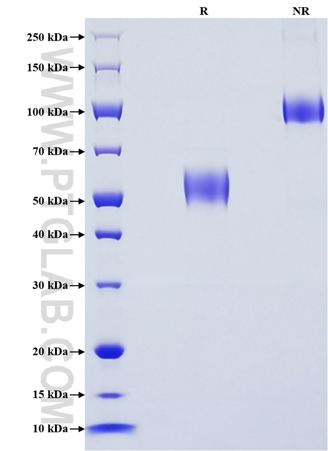 Purity of Recombinant Human CD79B was determined by SDS-PAGE. The protein was resolved in an SDS-PAGE in reducing (R) and non-reducing (NR) conditions and stained using Coomassie blue. Purity of Recombinant Human CD79B was determined by SDS-PAGE. The protein was resolved in an SDS-PAGE in reducing (R) and non-reducing (NR) conditions and stained using Coomassie blue.