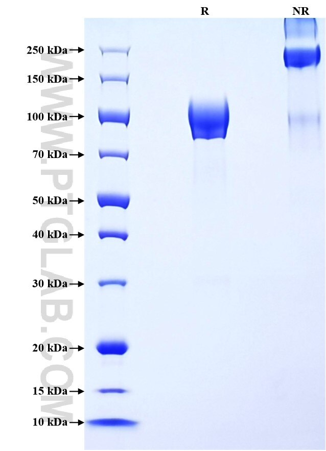 Purity of Recombinant Human CD6 was determined by SDS-PAGE. The protein was resolved in an SDS-PAGE in reducing (R) and non-reducing (NR) conditions and stained using Coomassie blue.