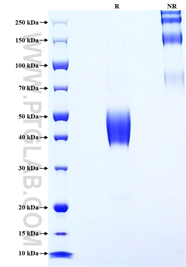 Purity of Recombinant Human PSCA was determined by SDS-PAGE. The protein was resolved in an SDS-PAGE in reducing (R) and non-reducing (NR) conditions and stained using Coomassie blue. Purity of Recombinant Human PSCA was determined by SDS-PAGE. The protein was resolved in an SDS-PAGE in reducing (R) and non-reducing (NR) conditions and stained using Coomassie blue.