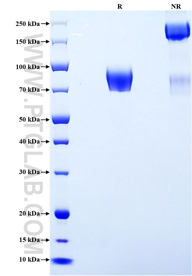 Purity of Recombinant Human FGFR1 was determined by SDS-PAGE. The protein was resolved in an SDS-PAGE in reducing (R) and non-reducing (NR) conditions and stained using Coomassie blue.