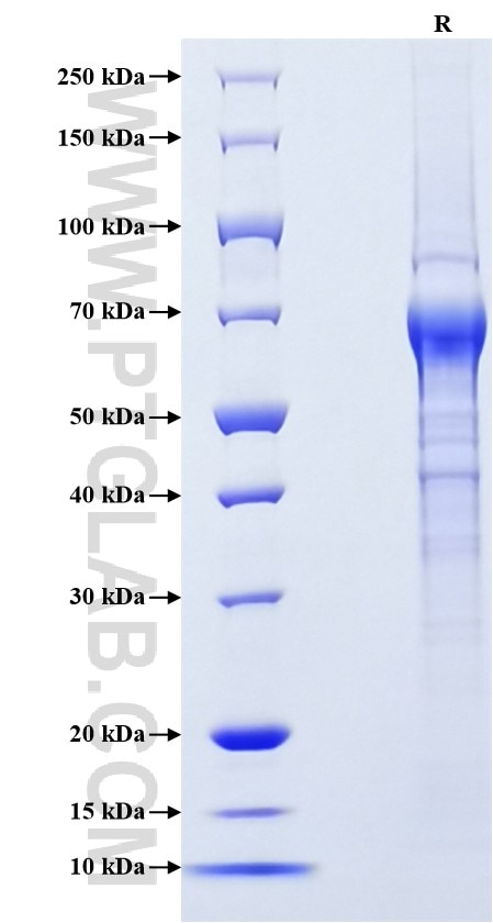 Purity of Recombinant Human CXCL16 was determined by SDS-PAGE. The protein was resolved in an SDS-PAGE in reducing (R) conditions and stained using Coomassie blue.